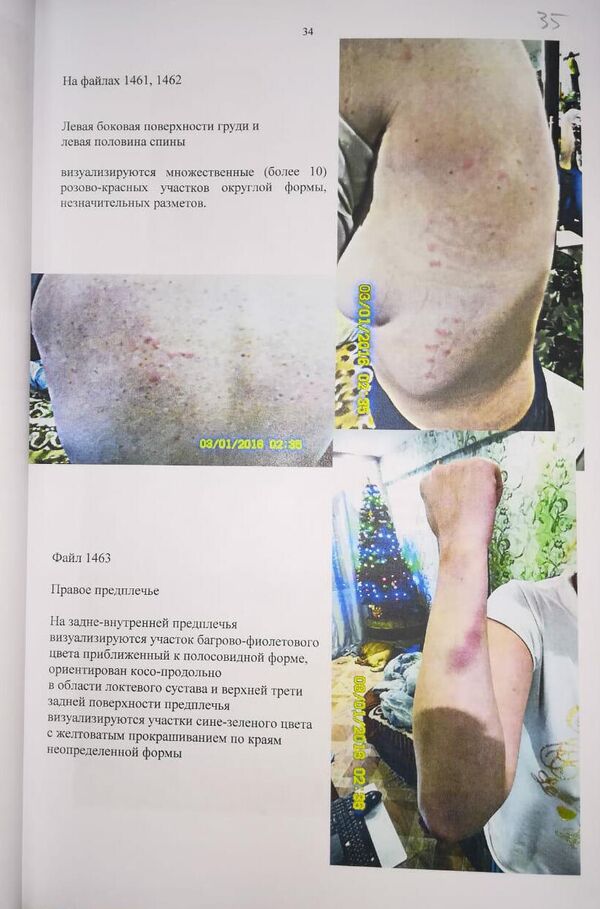 Фото побоев из материалов уголовного дела Фото побоев из материалов уголовного дела