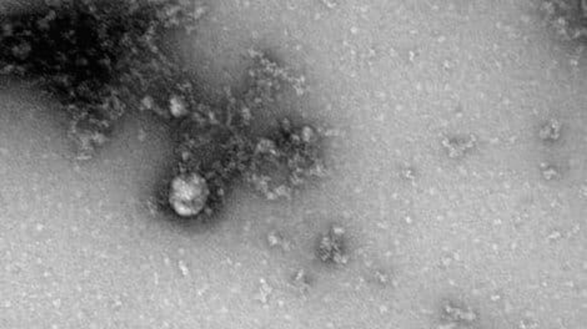 Ученые объяснили, почему "британский" штамм коронавируса такой заразный