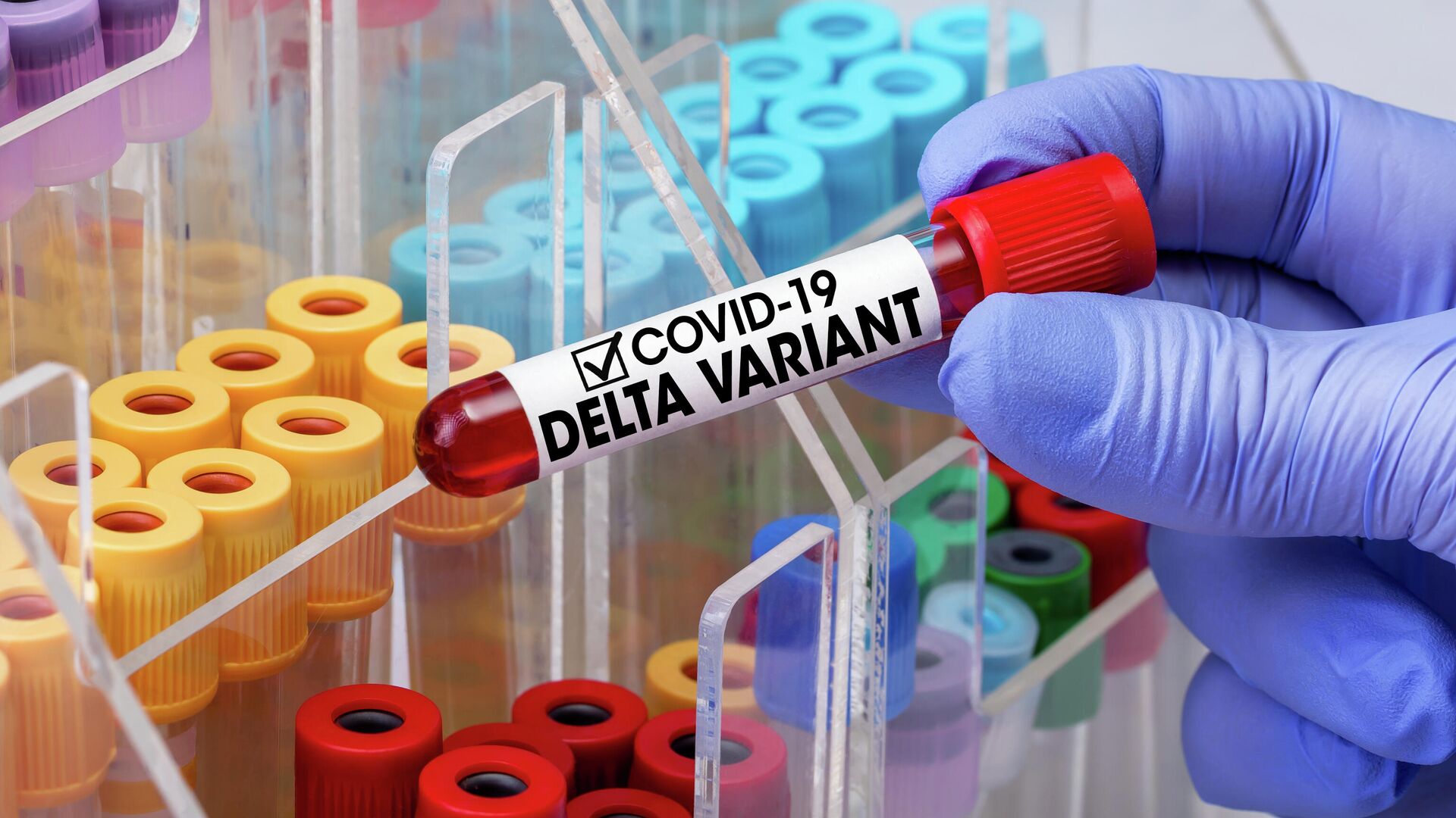 Ученые предупредили о риске появления устойчивого штамма коронавируса