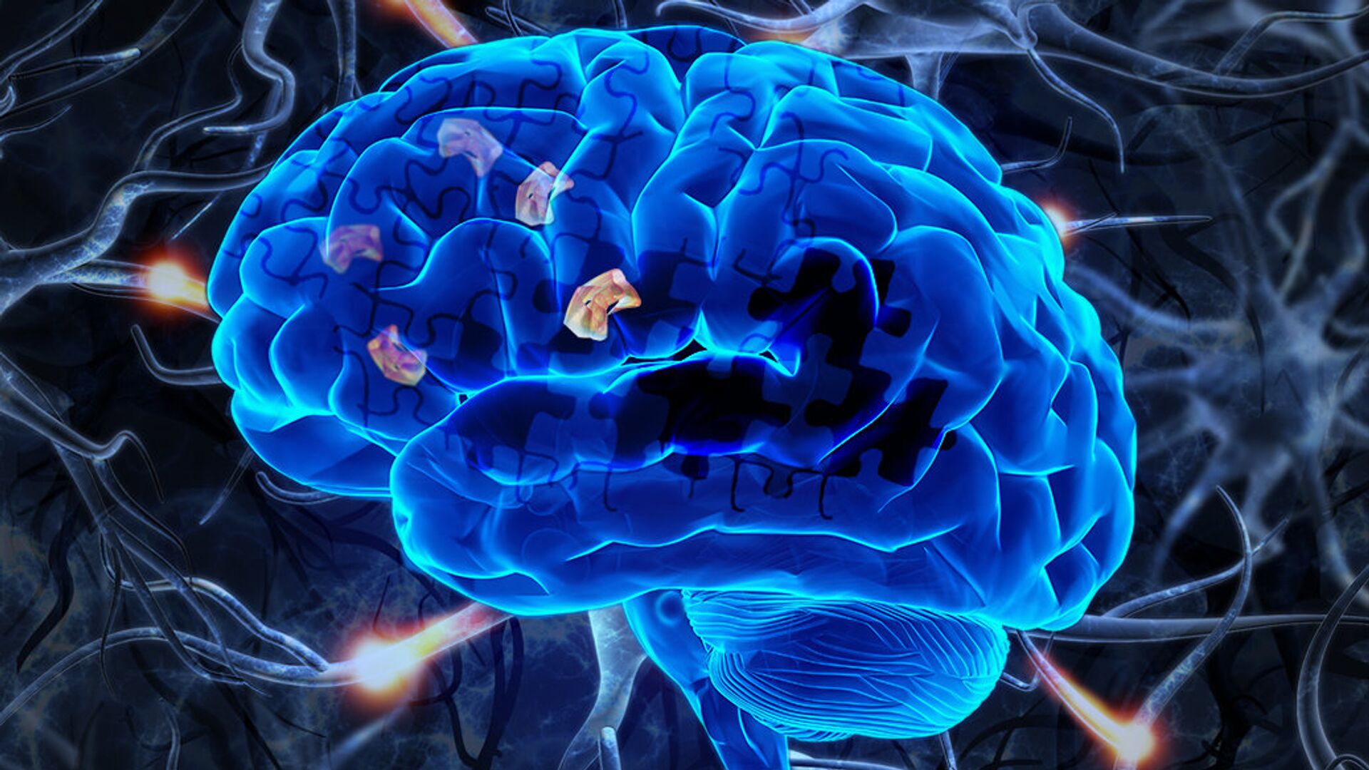 Российские ученые предложили новый метод изучения болезней мозга