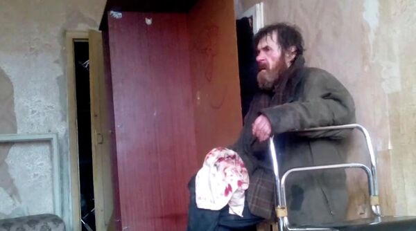 Бездомный, избитый подростками в Воронеже Бездомный, избитый подростками в Воронеже