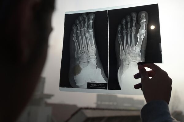 Девушка наблюдает солнечное затмение через рентгеновский снимок ноги в Пакистане. 26 декабря 2019 года Девушка наблюдает солнечное затмение через рентгеновский снимок ноги в Пакистане. 26 декабря 2019 года