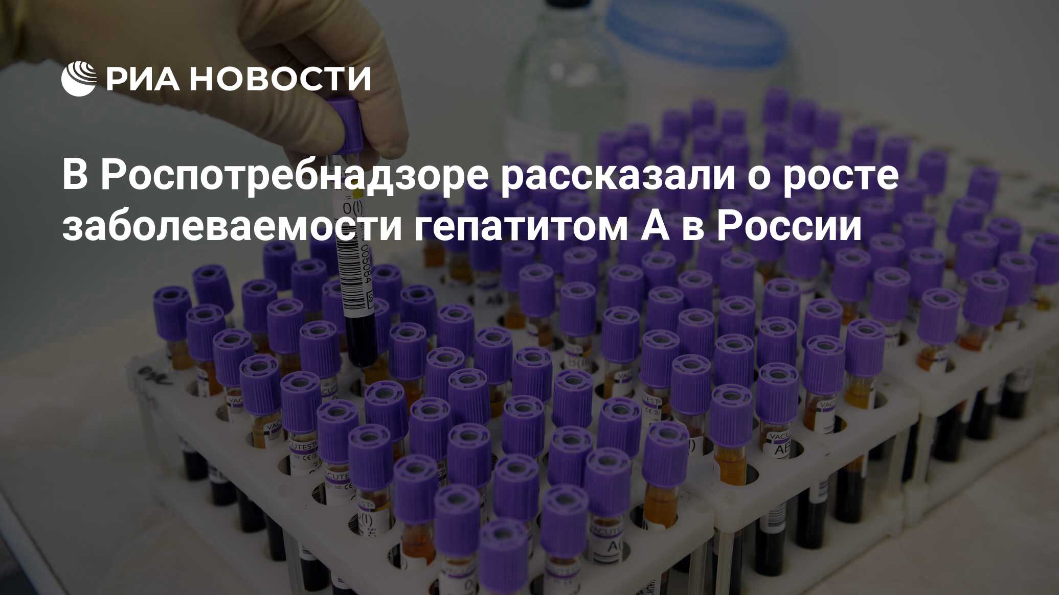 Рост заболеваемости гепатитом а в россии thumbnail